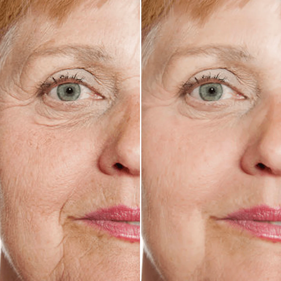 Sérum anti-âge RetinPure – Réduit visiblement rides et ridules en 14 jours