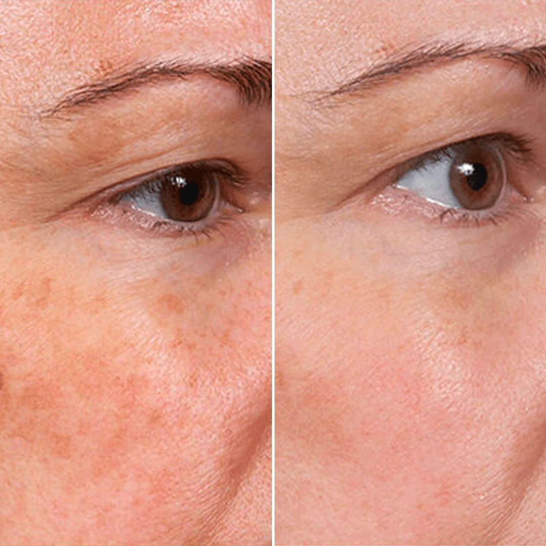 Sérum anti-âge RetinPure – Réduit visiblement rides et ridules en 14 jours