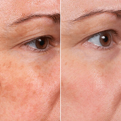 Sérum anti-âge RetinPure – Réduit visiblement rides et ridules en 14 jours